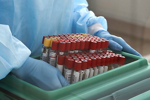 Врач объяснил, существуют ли единые нормы по холестерину