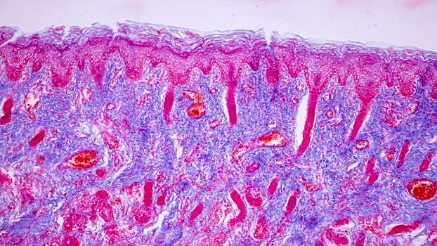 Стало известно, как восстанавливается вкус после заболеваний